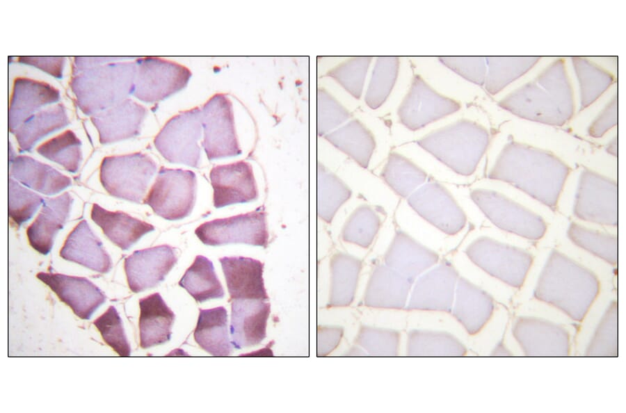 Immunohistochemistry - Anti-S6 Ribosomal Protein (phospho Ser240) Antibody (A0571) - Antibodies.com