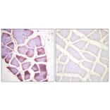 Immunohistochemistry - Anti-S6 Ribosomal Protein (phospho Ser240) Antibody (A0571) - Antibodies.com