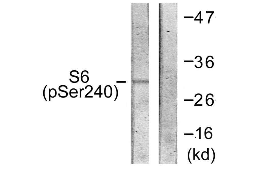 Western Blot - Anti-S6 Ribosomal Protein (phospho Ser240) Antibody (A0571) - Antibodies.com