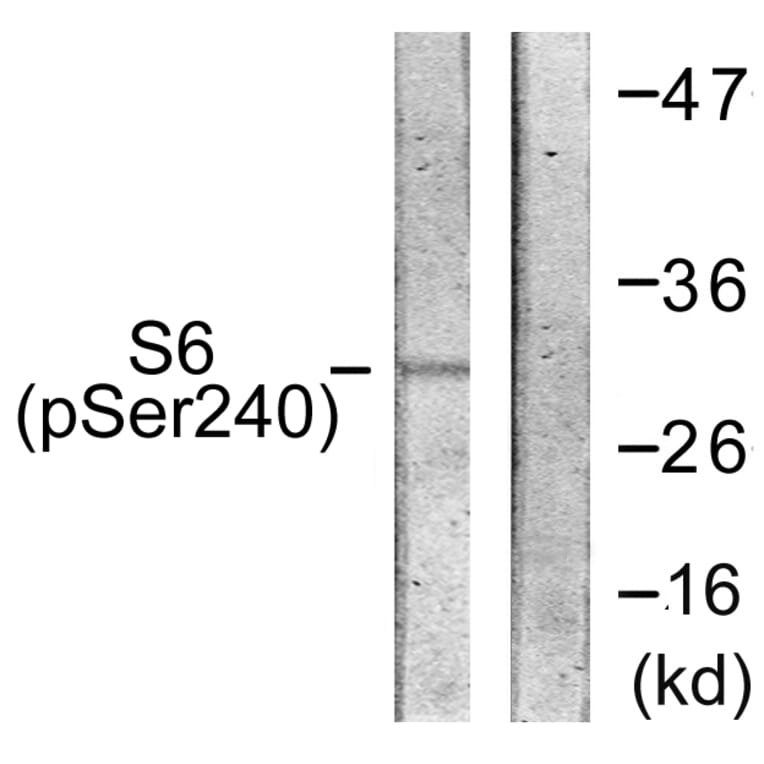 Western Blot - Anti-S6 Ribosomal Protein (phospho Ser240) Antibody (A0571) - Antibodies.com