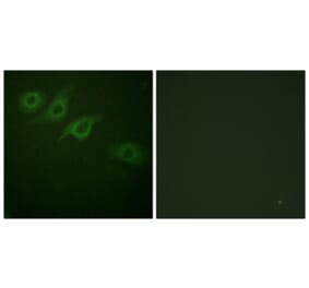 Immunofluorescence - Anti-Interferon-gamma Receptor alpha chain Antibody (B0953) - Antibodies.com