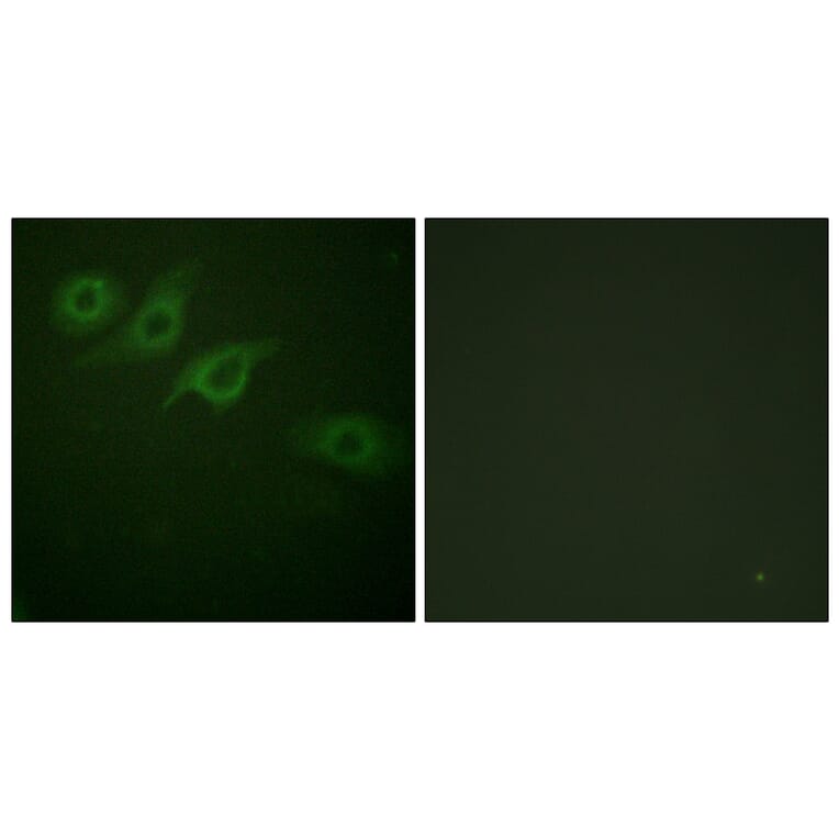 Immunofluorescence - Anti-Interferon-gamma Receptor alpha chain Antibody (B0953) - Antibodies.com