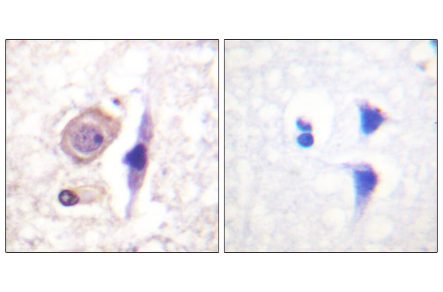 Immunohistochemistry - Anti-Interferon-gamma Receptor alpha chain Antibody (B0953) - Antibodies.com