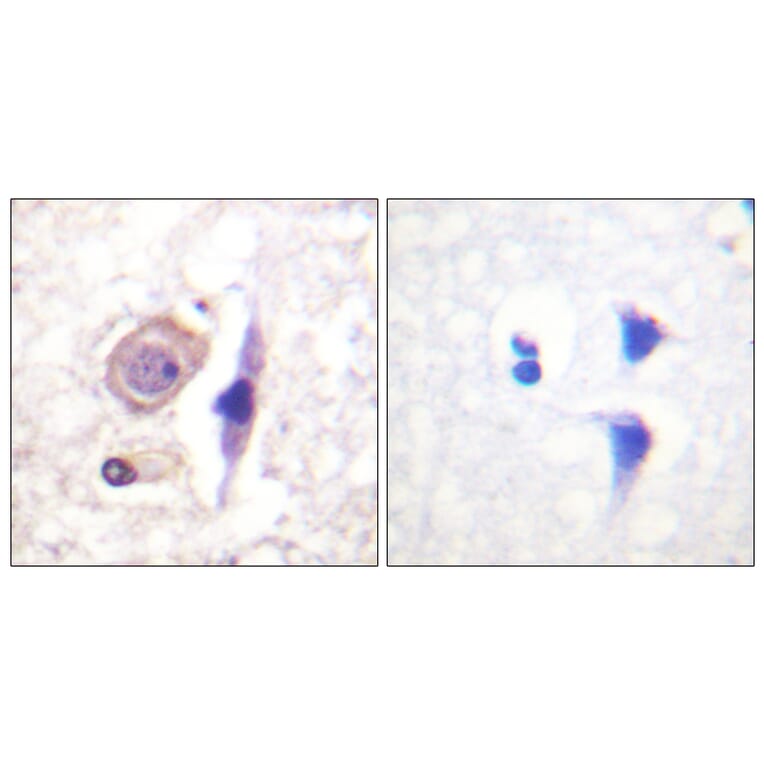 Immunohistochemistry - Anti-Interferon-gamma Receptor alpha chain Antibody (B0953) - Antibodies.com