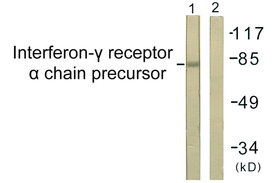 Western Blot - Anti-Interferon-gamma Receptor alpha chain Antibody (B0953) - Antibodies.com