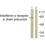 Western Blot - Anti-Interferon-gamma Receptor alpha chain Antibody (B0953) - Antibodies.com