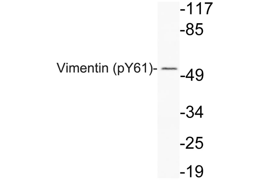 Western Blot - Anti-Vimentin (phospho Tyr61) Antibody (P12-1067) - Antibodies.com