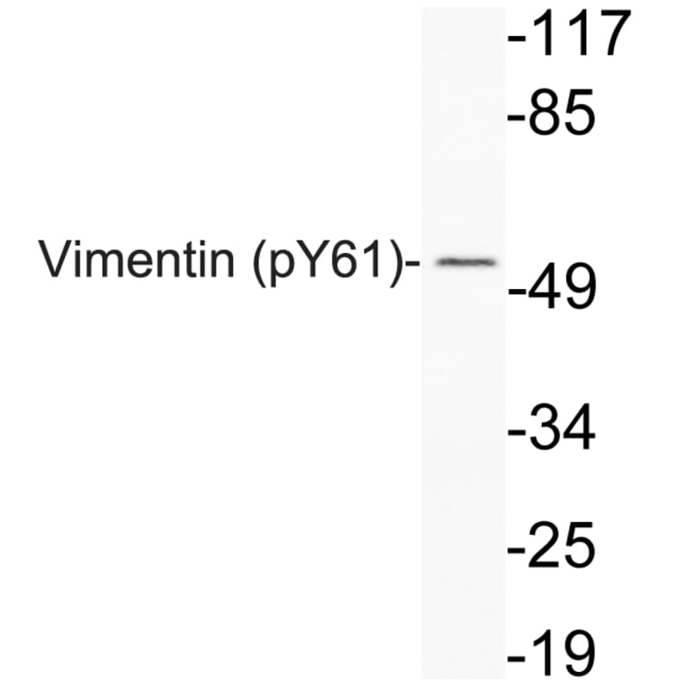 Western Blot - Anti-Vimentin (phospho Tyr61) Antibody (P12-1067) - Antibodies.com