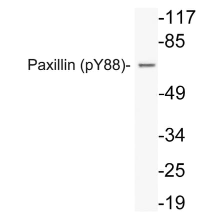 Western Blot - Anti-Paxillin (phospho Tyr88) Antibody (P12-1041) - Antibodies.com