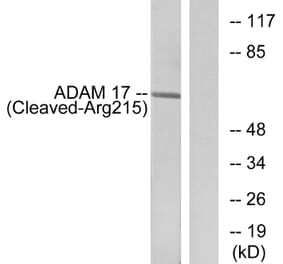 Western Blot - Anti-ADAM 17 (cleaved Arg215) Antibody (L0130) - Antibodies.com
