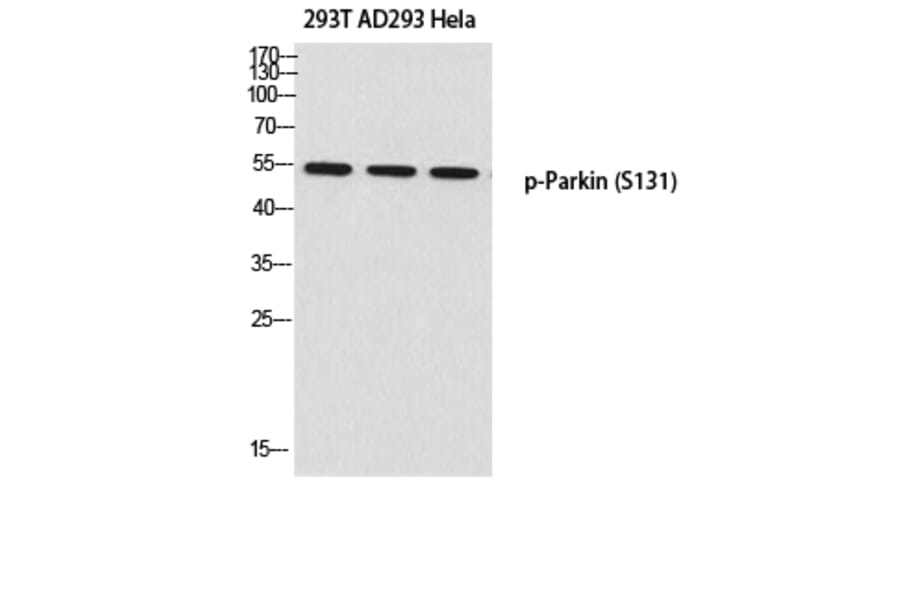 Western Blot - Anti-Parkin (phospho Ser131) Antibody (A0542) - Antibodies.com