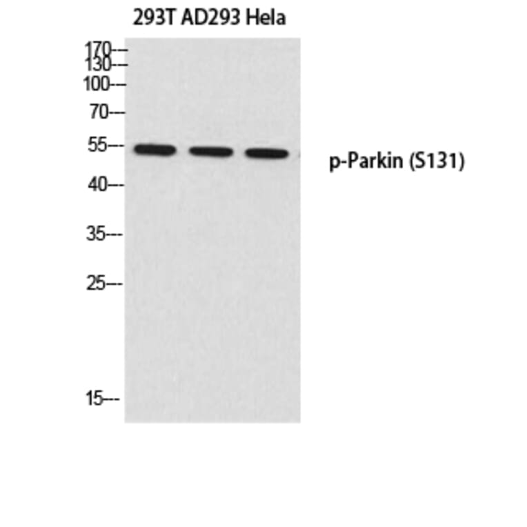 Western Blot - Anti-Parkin (phospho Ser131) Antibody (A0542) - Antibodies.com