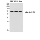 Western Blot - Anti-Parkin (phospho Ser131) Antibody (A0542) - Antibodies.com