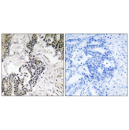 Immunohistochemistry - Anti-CDC25C (phospho Ser198) Antibody (A8311) - Antibodies.com