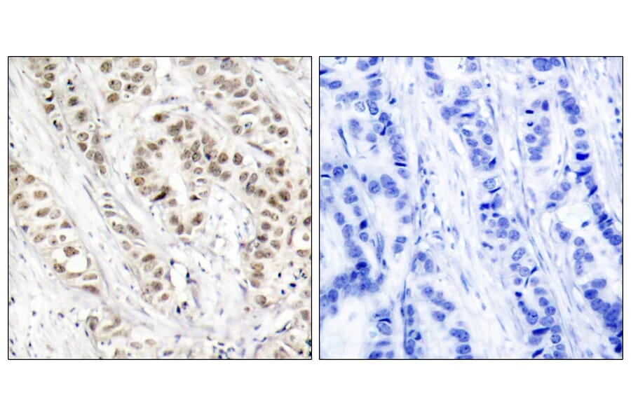 Immunohistochemistry - Anti-BRCA1 (phospho Ser1524) Antibody (A7031) - Antibodies.com