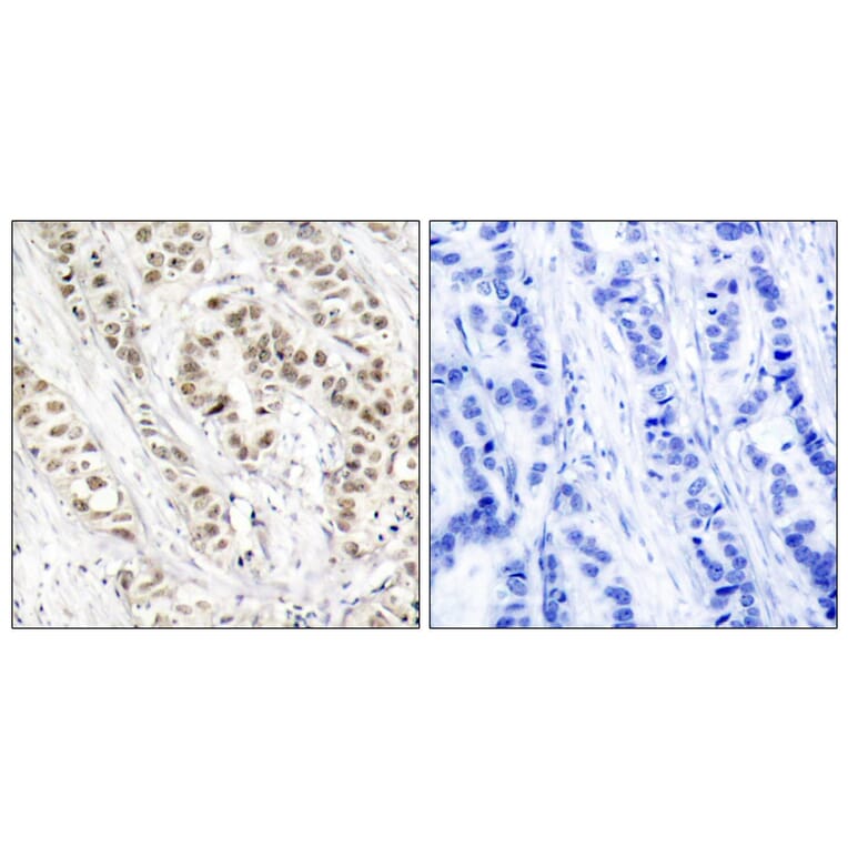 Immunohistochemistry - Anti-BRCA1 (phospho Ser1524) Antibody (A7031) - Antibodies.com