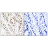 Immunohistochemistry - Anti-BRCA1 (phospho Ser1524) Antibody (A7031) - Antibodies.com