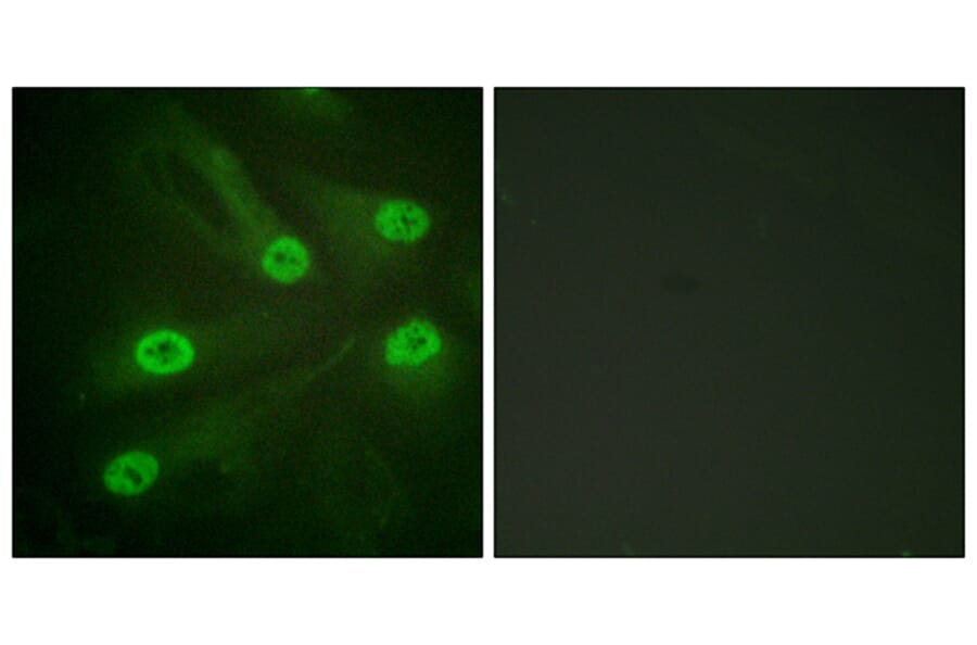 Immunofluorescence - Anti-p53 (acetyl Lys386) Antibody (D0017) - Antibodies.com