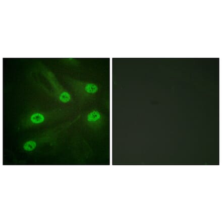 Immunofluorescence - Anti-p53 (acetyl Lys386) Antibody (D0017) - Antibodies.com