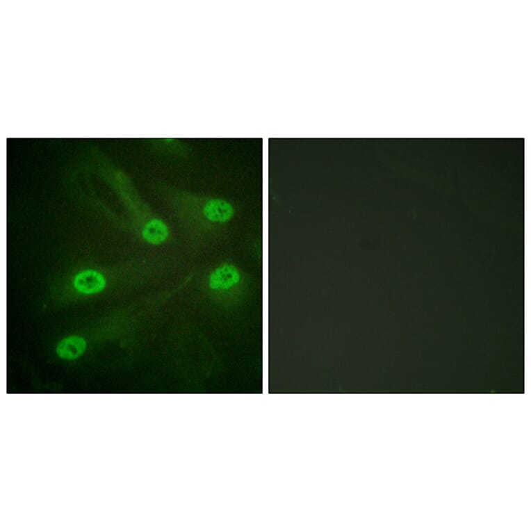 Immunofluorescence - Anti-p53 (acetyl Lys386) Antibody (D0017) - Antibodies.com