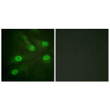 Immunofluorescence - Anti-p53 (acetyl Lys386) Antibody (D0017) - Antibodies.com