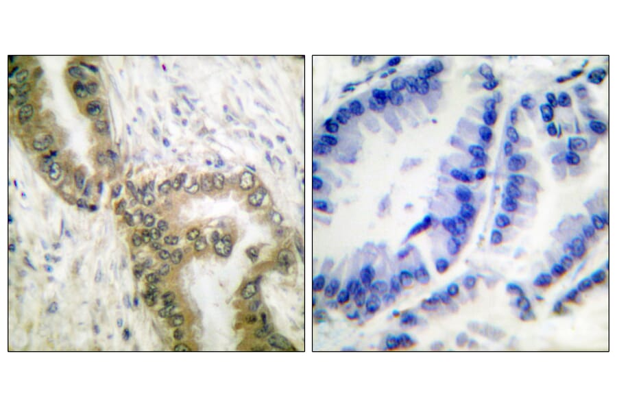 Immunohistochemistry - Anti-p53 (acetyl Lys386) Antibody (D0017) - Antibodies.com
