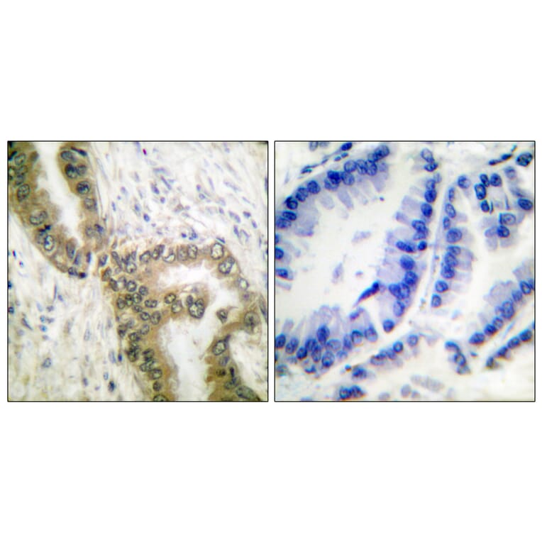 Immunohistochemistry - Anti-p53 (acetyl Lys386) Antibody (D0017) - Antibodies.com