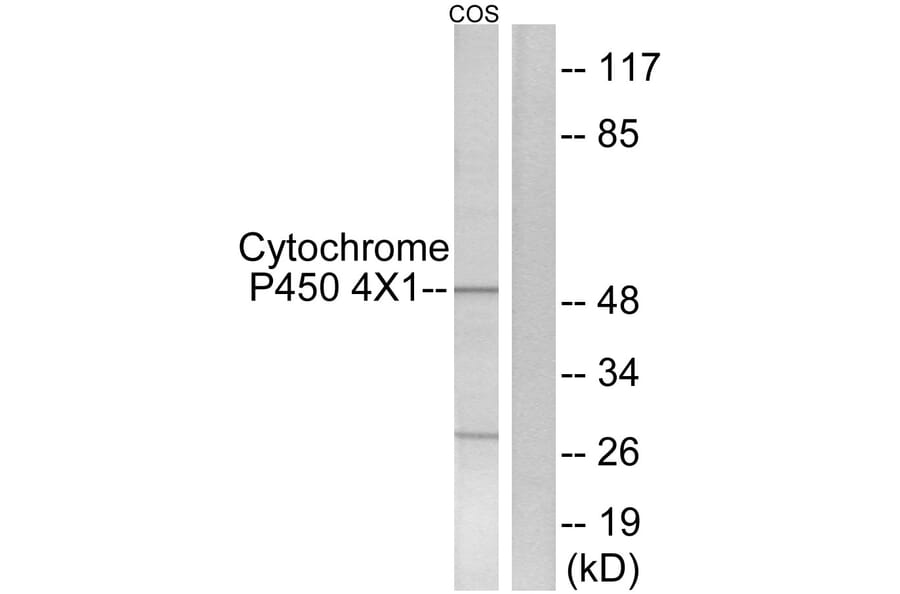 Western Blot - Anti-Cytochrome P450 4X1 Antibody (C12290) - Antibodies.com