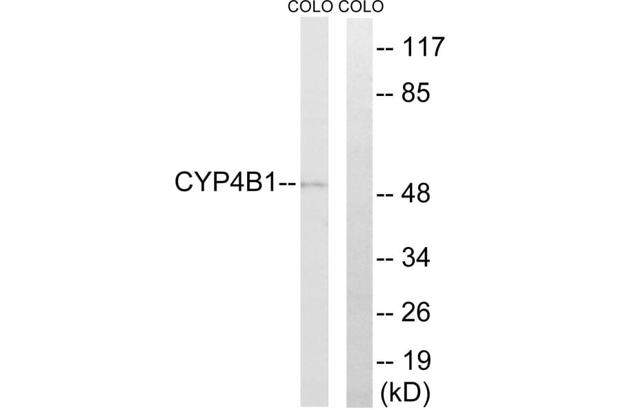 Western Blot - Anti-Cytochrome P450 4B1 Antibody (C12282) - Antibodies.com