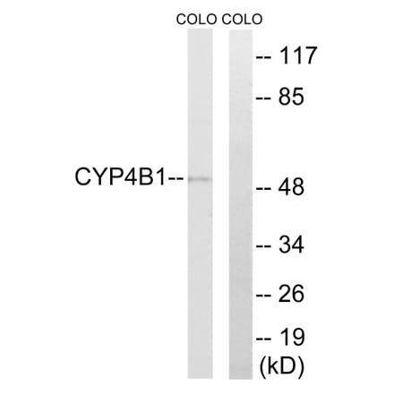 Western Blot - Anti-Cytochrome P450 4B1 Antibody (C12282) - Antibodies.com