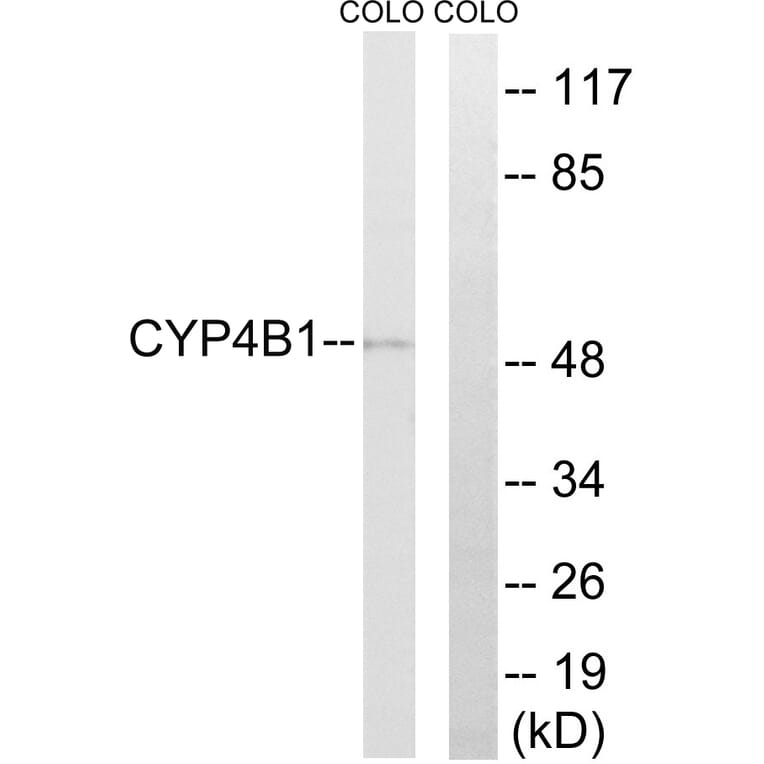 Western Blot - Anti-Cytochrome P450 4B1 Antibody (C12282) - Antibodies.com