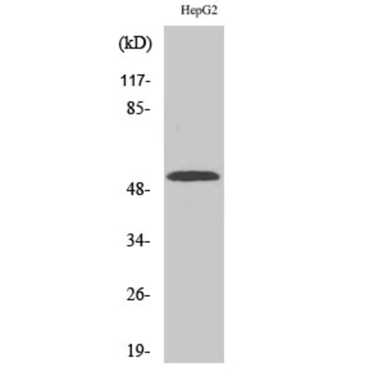 Western Blot - Anti-Cytochrome P450 2W1 Antibody (C12273) - Antibodies.com