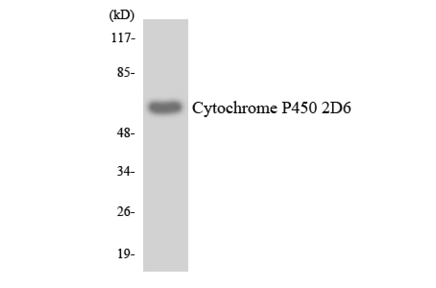 Western Blot - Anti-Cytochrome P450 2D6 Antibody (R12-2678) - Antibodies.com