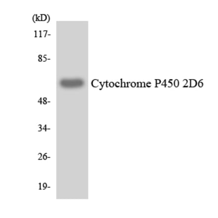 Western Blot - Anti-Cytochrome P450 2D6 Antibody (R12-2678) - Antibodies.com