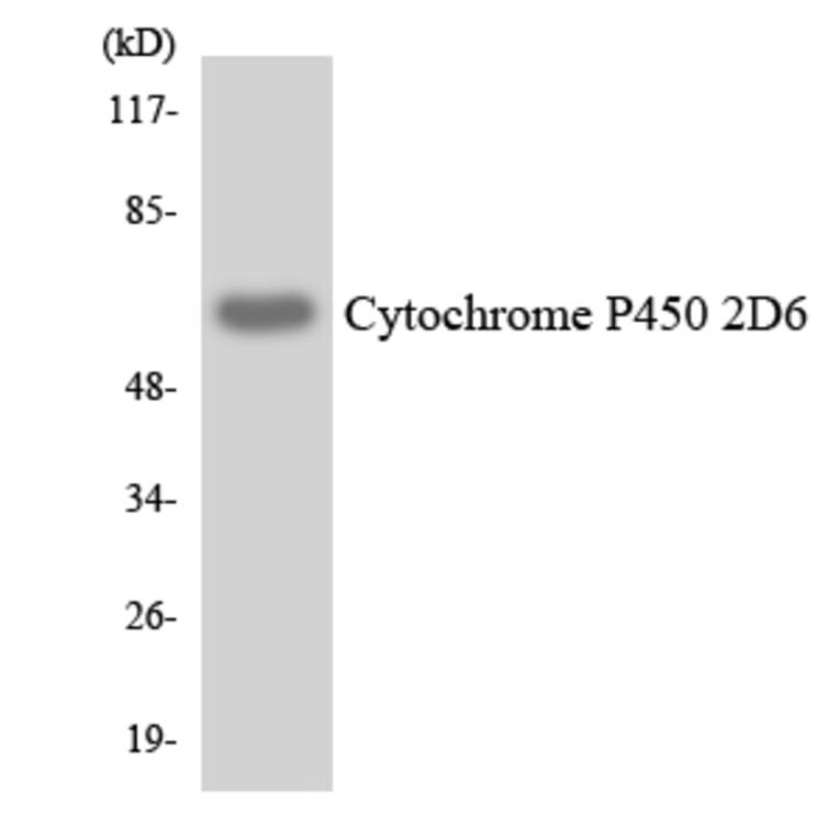 Western Blot - Anti-Cytochrome P450 2D6 Antibody (R12-2678) - Antibodies.com