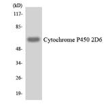 Western Blot - Anti-Cytochrome P450 2D6 Antibody (R12-2678) - Antibodies.com