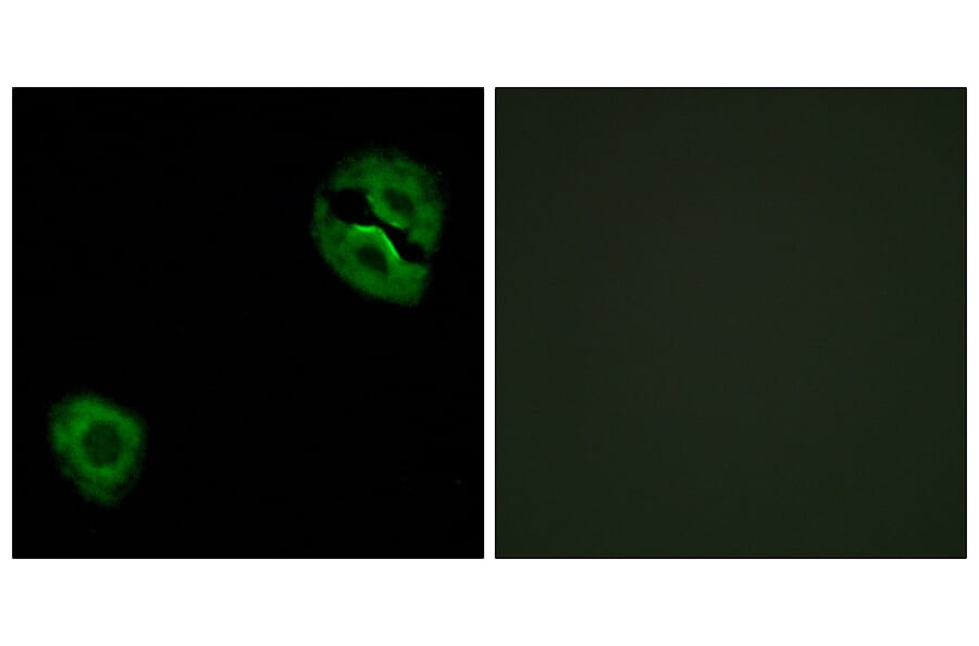 Immunofluorescence - Anti-Collagen XIX alpha1 Antibody (C12224) - Antibodies.com