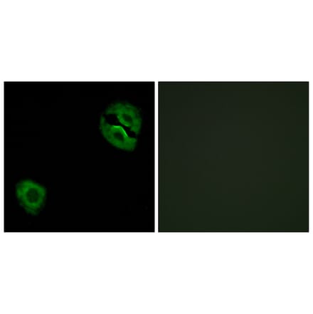 Immunofluorescence - Anti-Collagen XIX alpha1 Antibody (C12224) - Antibodies.com