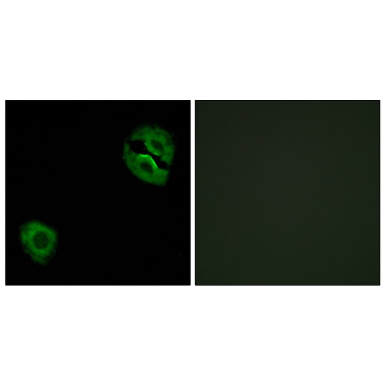Immunofluorescence - Anti-Collagen XIX alpha1 Antibody (C12224) - Antibodies.com