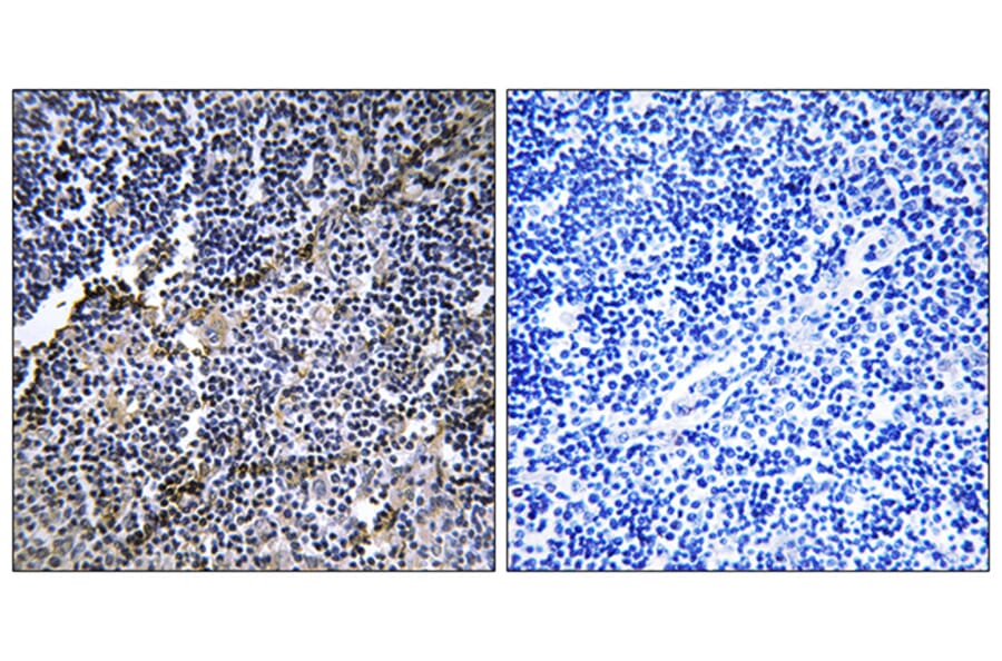 Immunohistochemistry - Anti-Collagen XIX alpha1 Antibody (C12224) - Antibodies.com