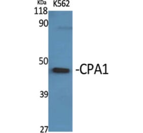 Western Blot - Anti-Carboxypeptidase A1 Antibody (C21478) - Antibodies.com