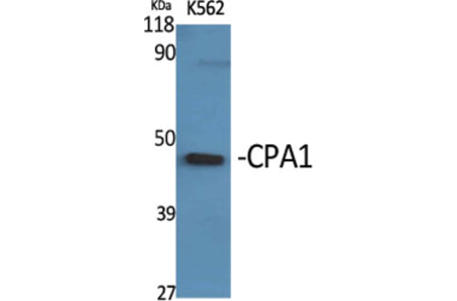 Western Blot - Anti-Carboxypeptidase A1 Antibody (C21478) - Antibodies.com