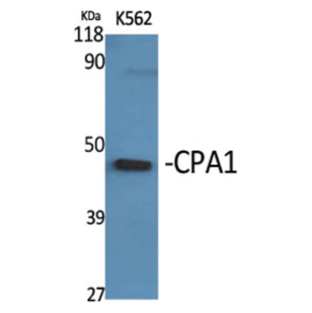 Western Blot - Anti-Carboxypeptidase A1 Antibody (C21478) - Antibodies.com