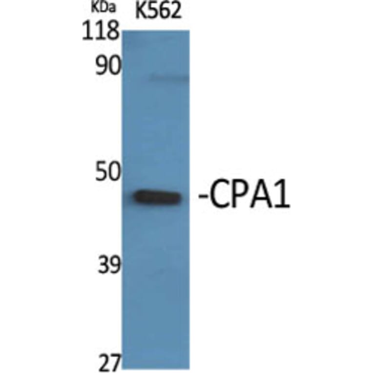 Western Blot - Anti-Carboxypeptidase A1 Antibody (C21478) - Antibodies.com