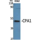 Western Blot - Anti-Carboxypeptidase A1 Antibody (C21478) - Antibodies.com