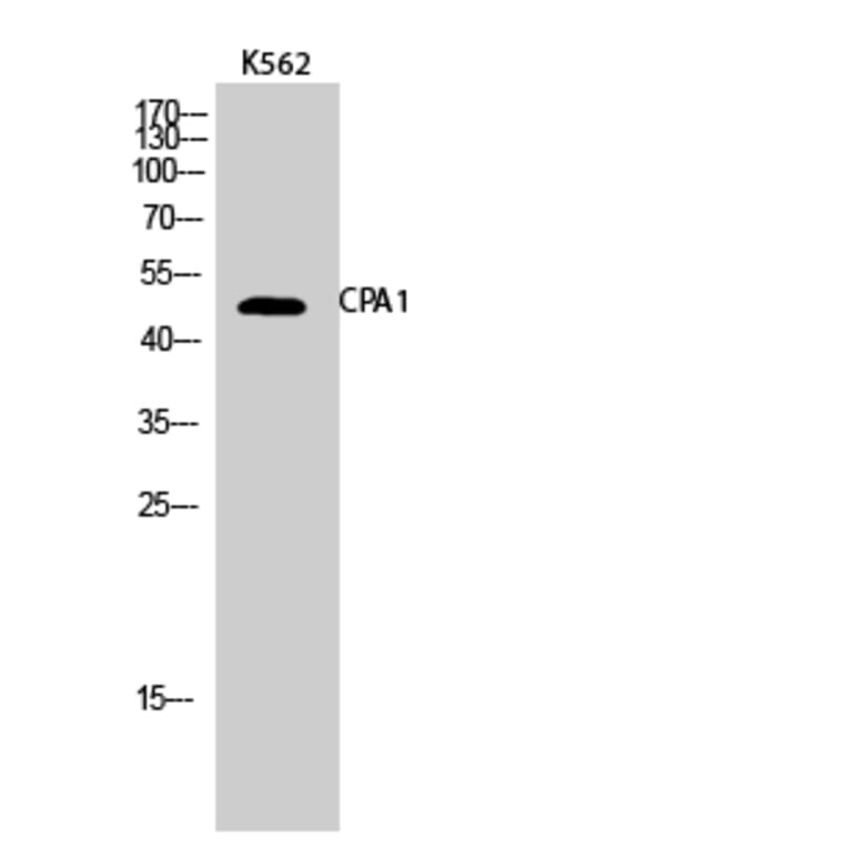 Western Blot - Anti-Carboxypeptidase A1 Antibody (C21478) - Antibodies.com