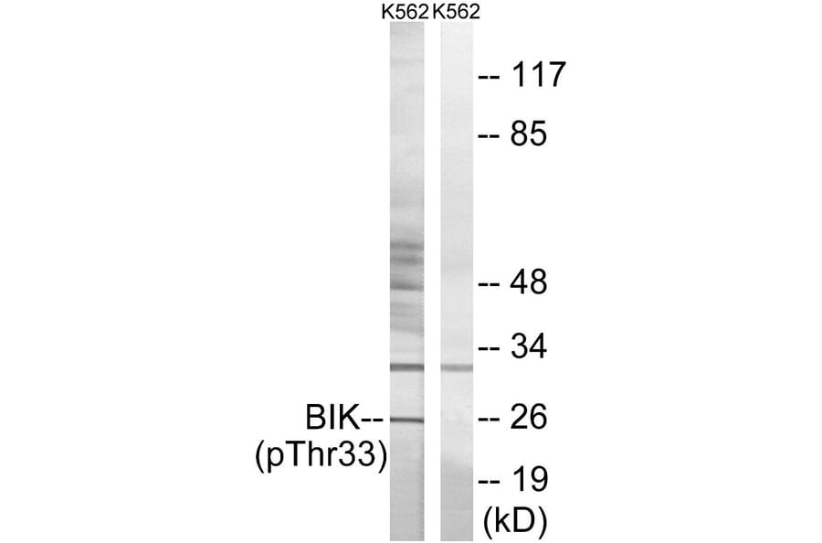 Western Blot - Anti-BIK (phospho Thr33) Antibody (A0053) - Antibodies.com