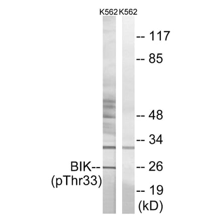 Western Blot - Anti-BIK (phospho Thr33) Antibody (A0053) - Antibodies.com