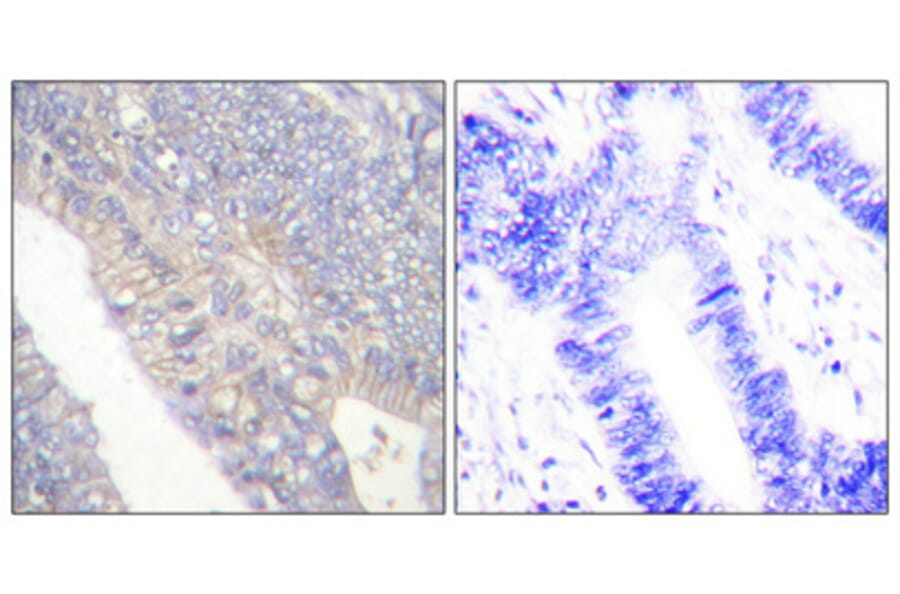 Immunohistochemistry - Anti-BIK (phospho Thr33) Antibody (A0053) - Antibodies.com