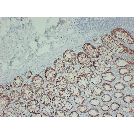 Immunohistochemistry - Anti-TGF beta Receptor I Antibody (V0129) - Antibodies.com